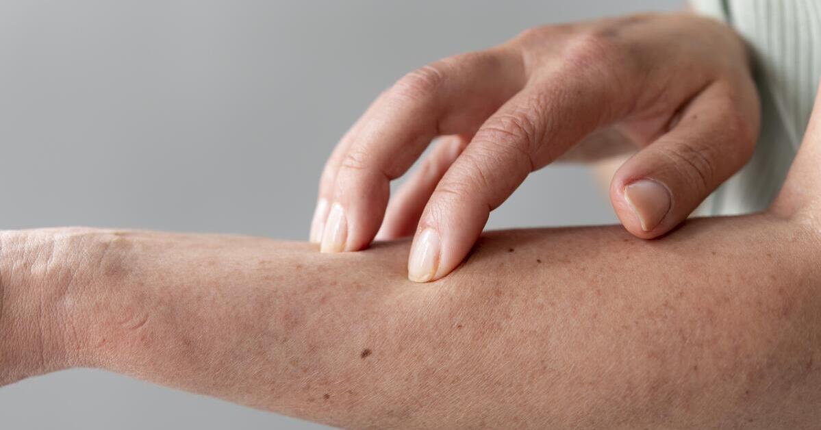 Kebiasaan Sehari Hari Penyebab Alergi Kulit Memahami Pemicu Dan Cara Mengatasinya